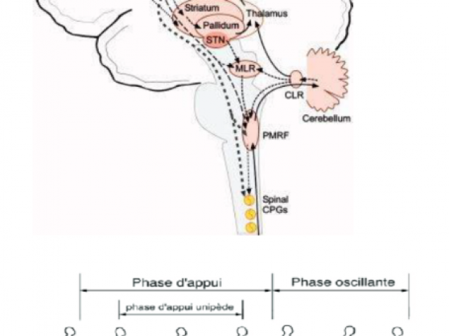 Pathologies neurodégénératives , bilan podologique et indications semelles