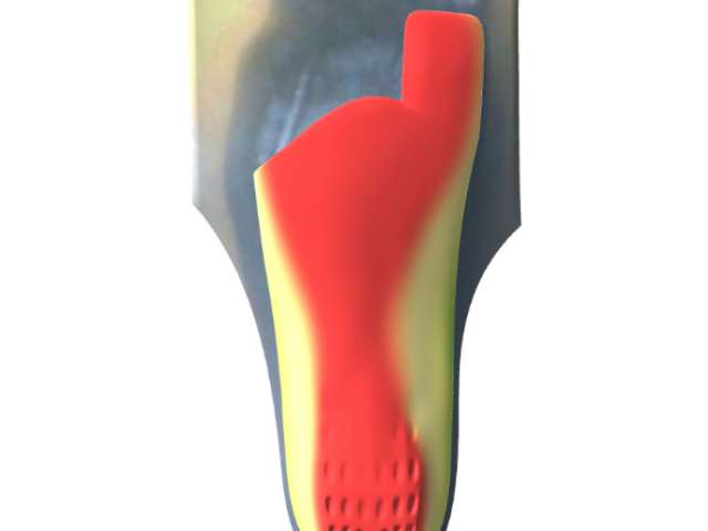 Présentation semelles orthopédiques 3D et différences avec le thermoformage